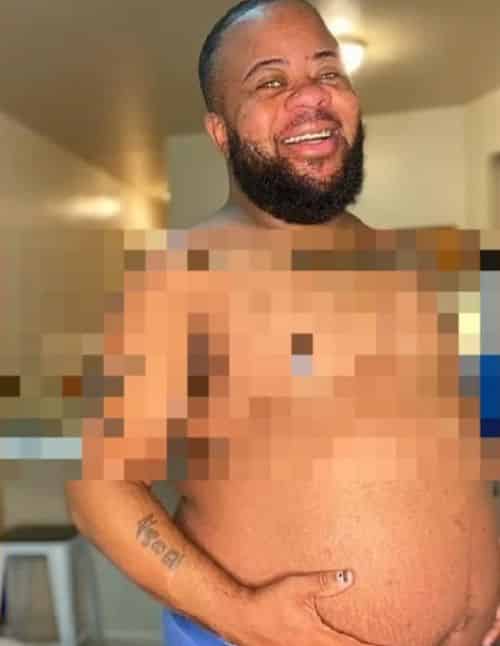 Keajaiban dunia, lelaki berjambang ini disahkan mengandung bayi kembar